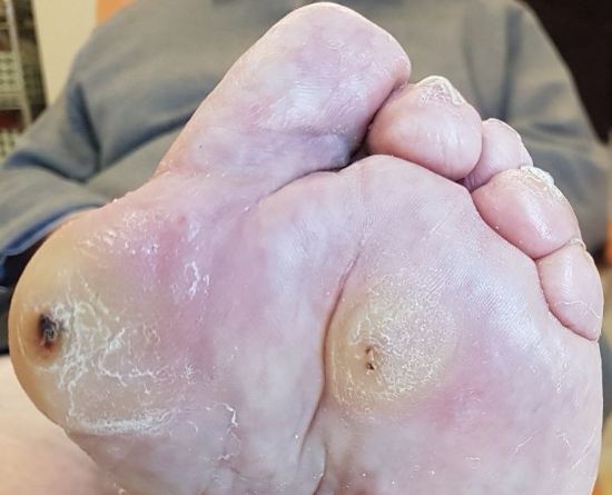 Le pied dermatologique